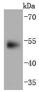 PAX6 Rabbit mAb