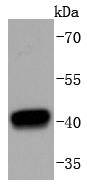 HDAC8 Rabbit mAb