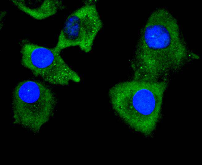 Collagen VI Rabbit mAb