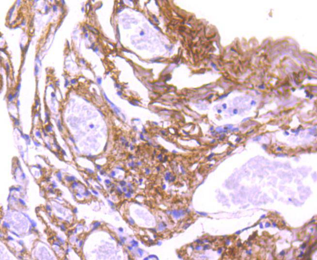 Collagen VI Rabbit mAb