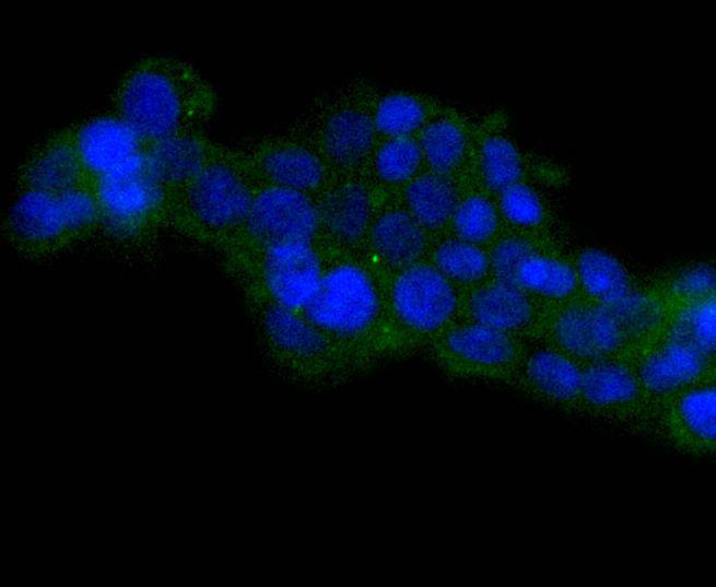 HSPA14 Rabbit mAb