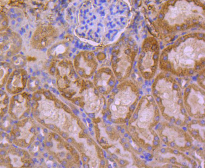 HSPA14 Rabbit mAb