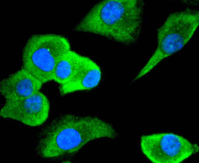 Cdc34 Rabbit mAb