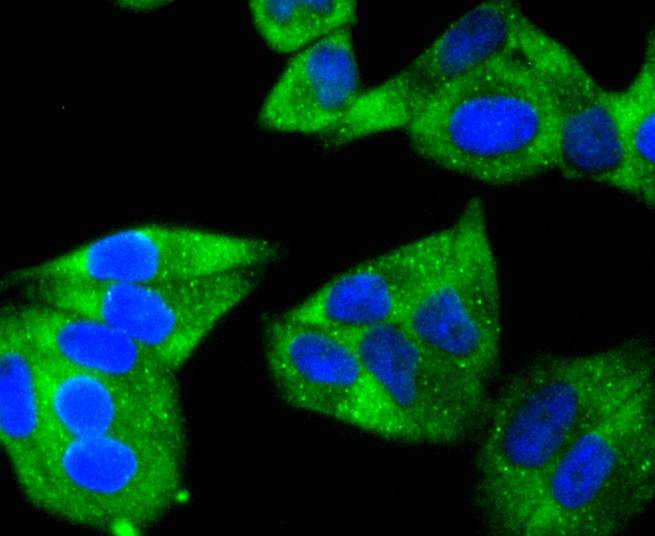 Hsp22 Rabbit mAb