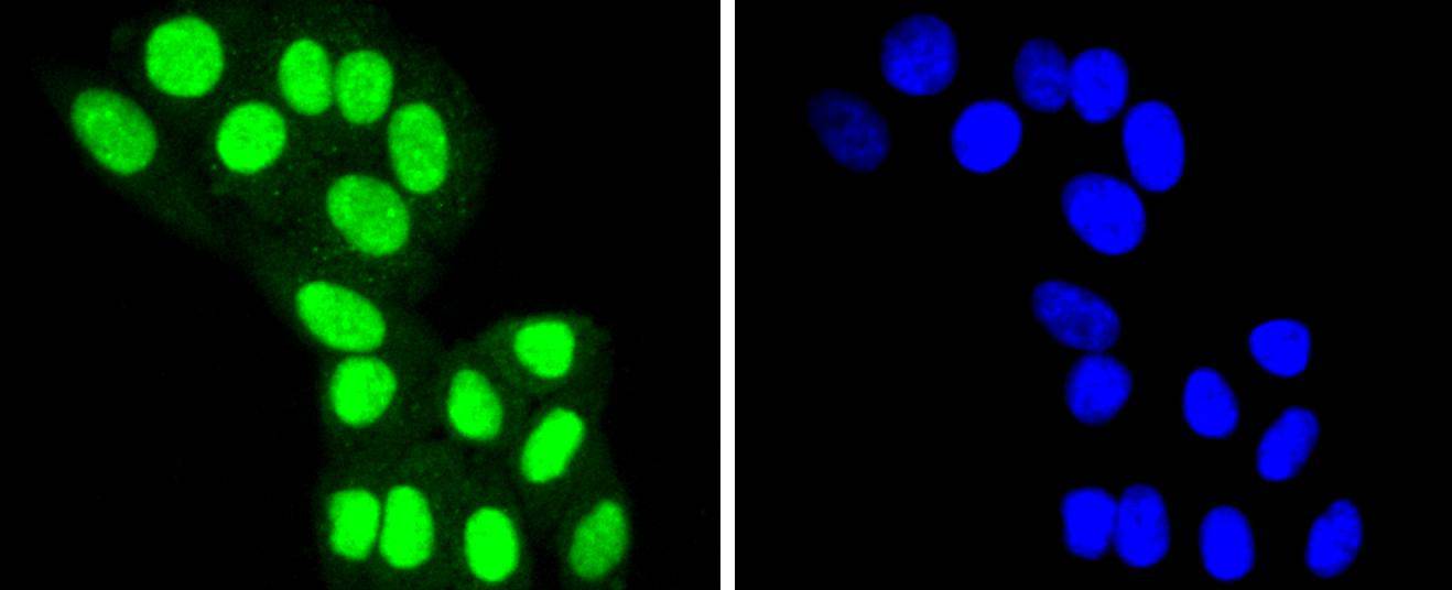 HDAC8 Rabbit mAb