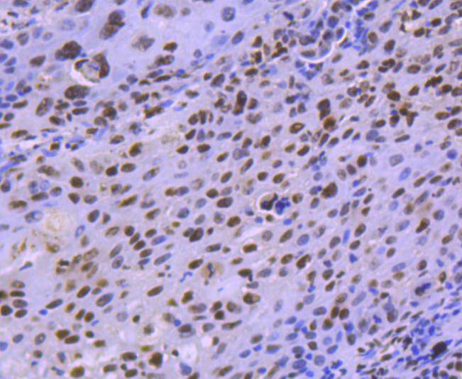 HDAC8 Rabbit mAb