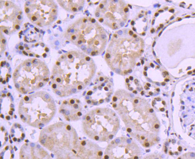 HDAC8 Rabbit mAb