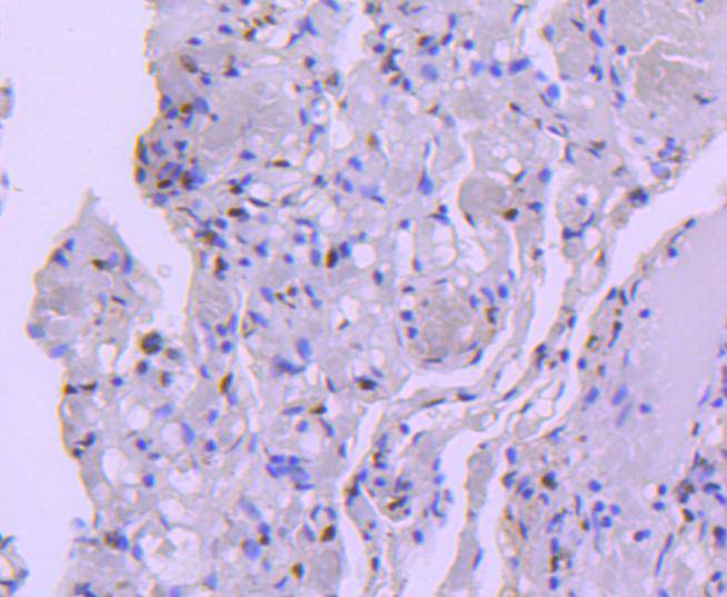 HDAC8 Rabbit mAb