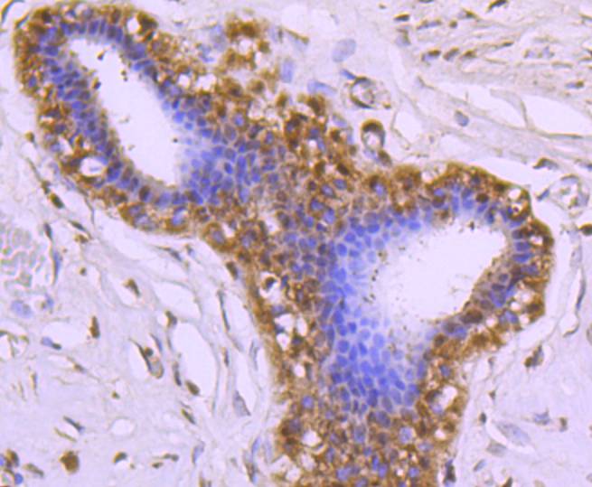 Cdc37 Rabbit mAb