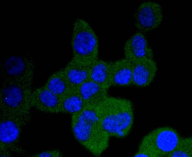 TrkA+B+C Rabbit mAb