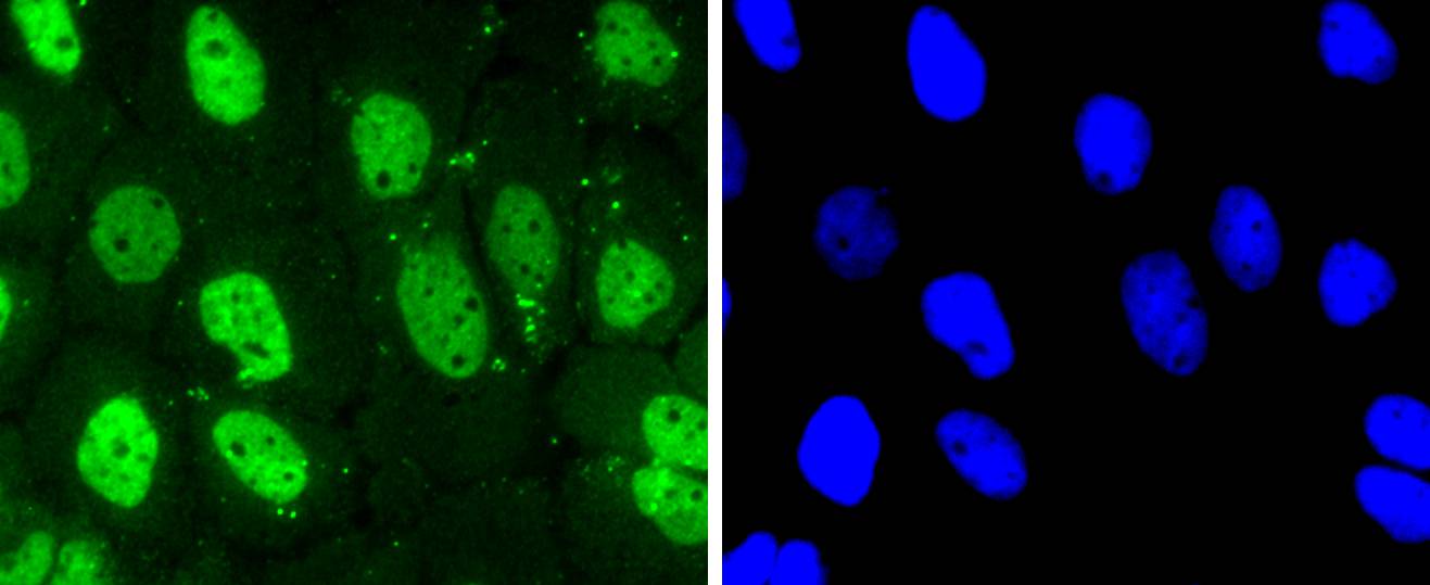 Cdk7 Rabbit mAb