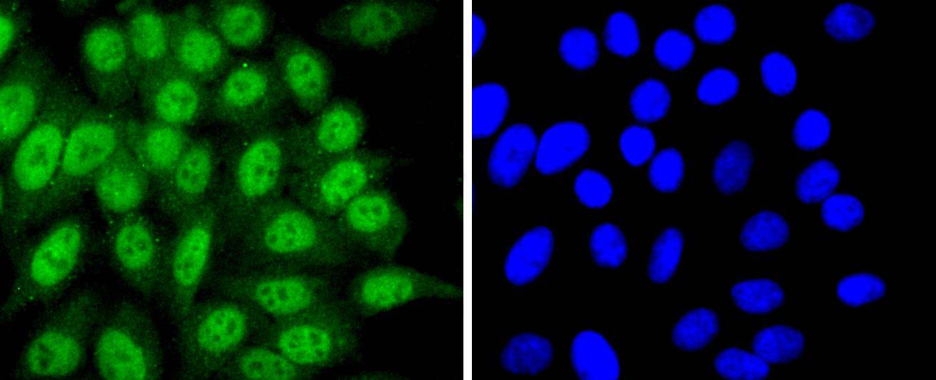 Cdk7 Rabbit mAb