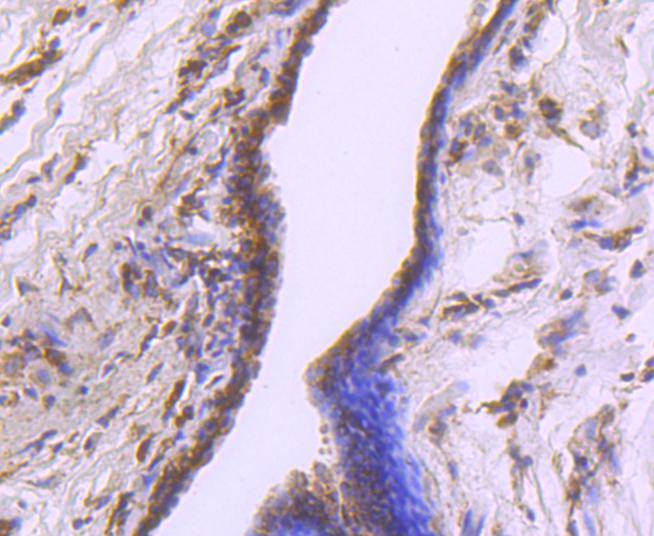 Cdk7 Rabbit mAb