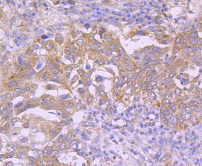 Cdk7 Rabbit mAb