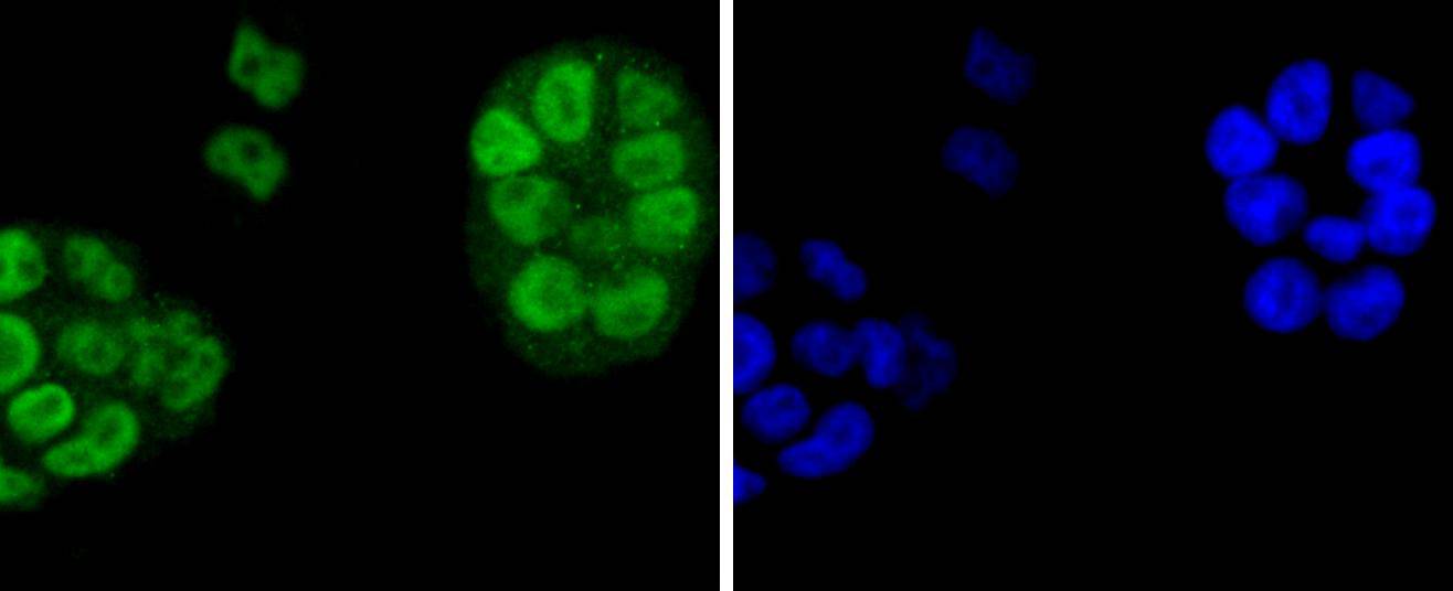 EIF2C3/ Argonaute 3 Rabbit mAb