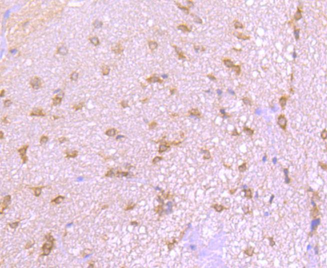 EIF2C3/ Argonaute 3 Rabbit mAb