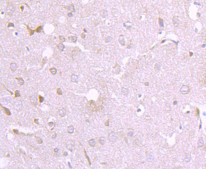 EIF2C3/ Argonaute 3 Rabbit mAb