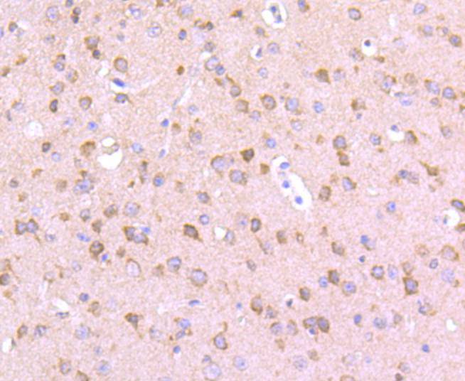 EIF2C3/ Argonaute 3 Rabbit mAb