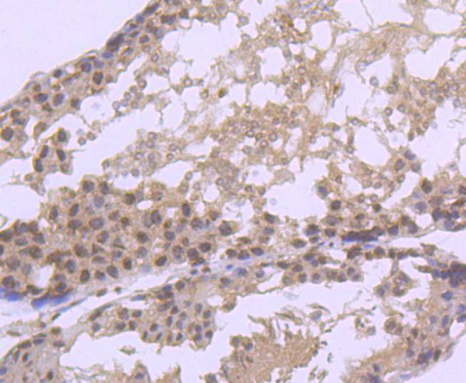 EIF2C3/ Argonaute 3 Rabbit mAb