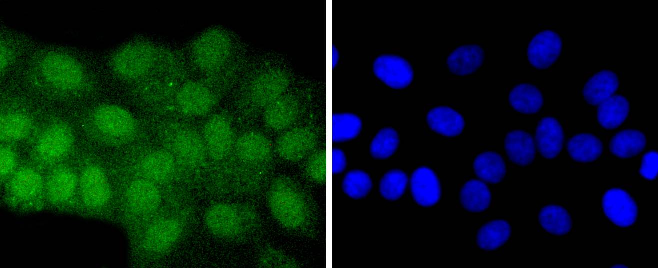 ATF7 Rabbit mAb