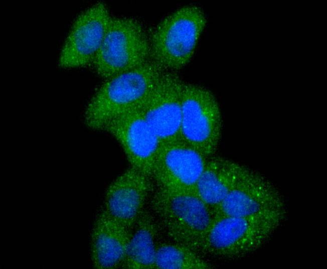 ATF7 Rabbit mAb