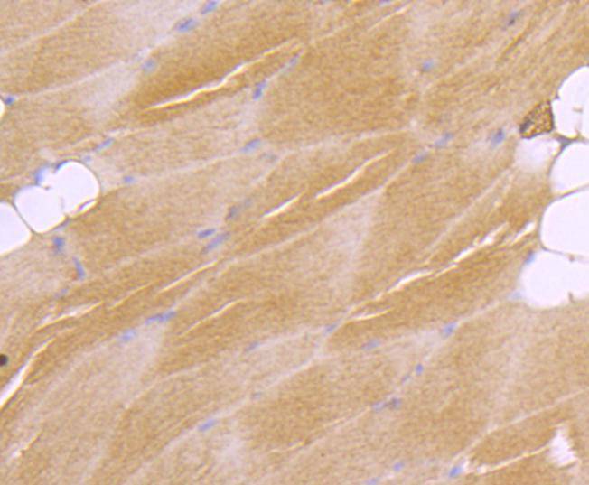 ATF7 Rabbit mAb