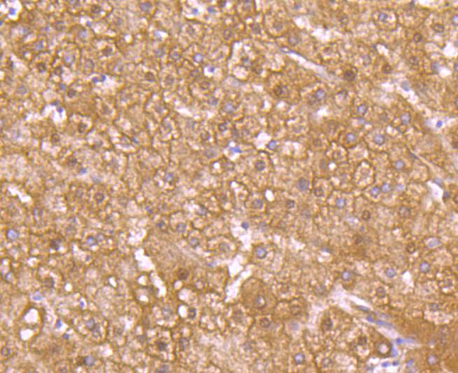 GLUT2 Rabbit mAb