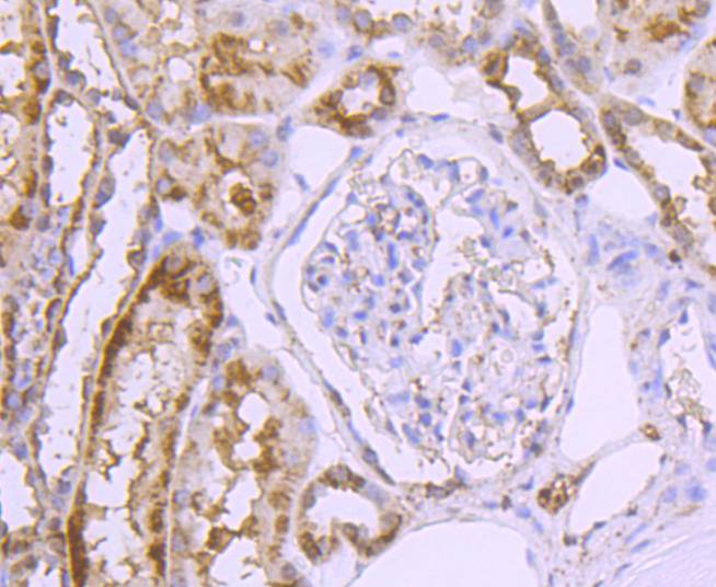 GLUT2 Rabbit mAb