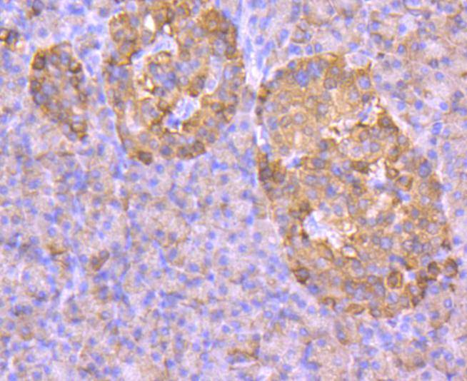 GLUT2 Rabbit mAb