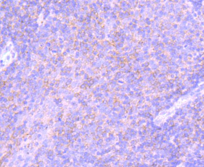 PD-L1 Rabbit mAb