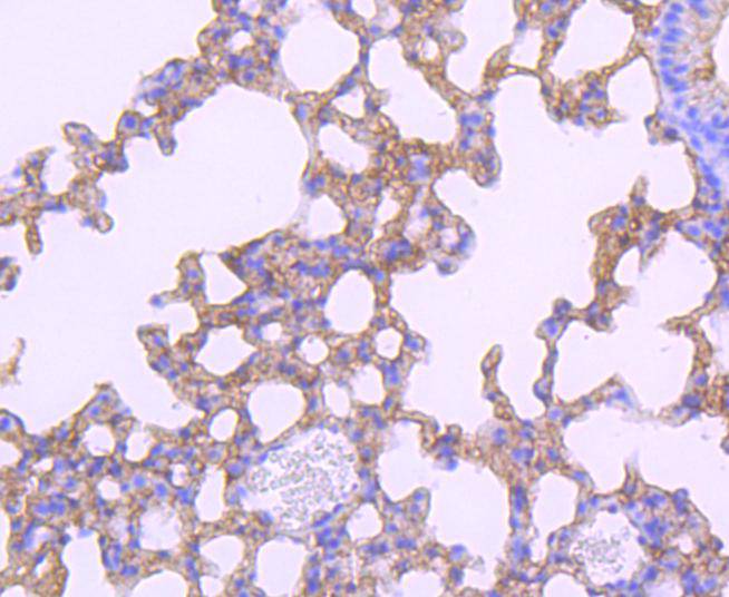 PD-L1 Rabbit mAb