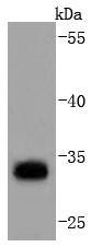 PD-L1 Rabbit mAb