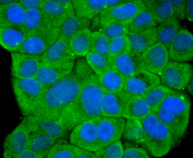 STAT4 Rabbit mAb