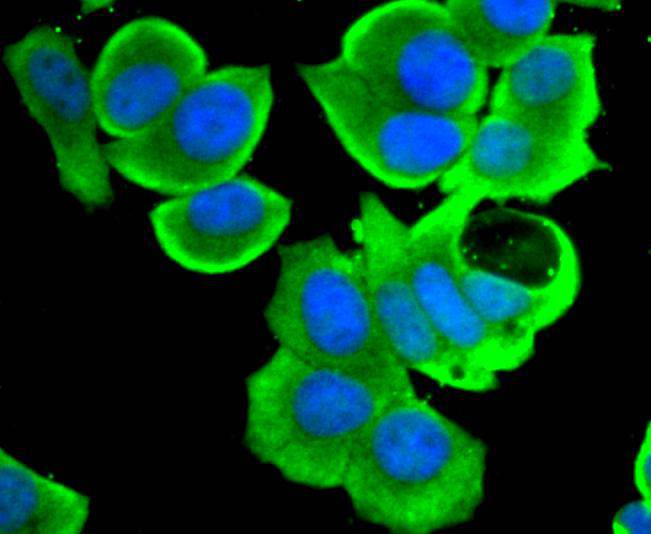 STAT4 Rabbit mAb