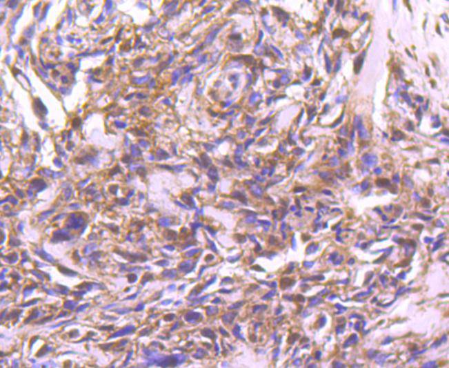 STAT4 Rabbit mAb