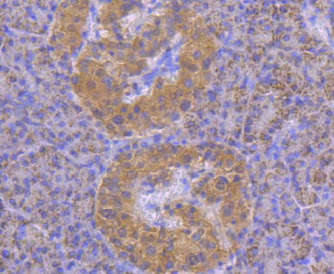 STAT4 Rabbit mAb