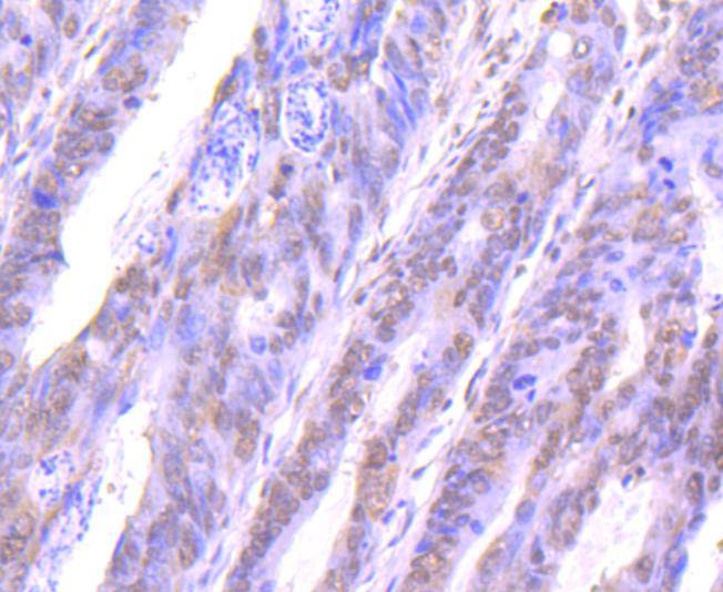 STAT4 Rabbit mAb