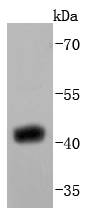 SIRT2 Rabbit mAb