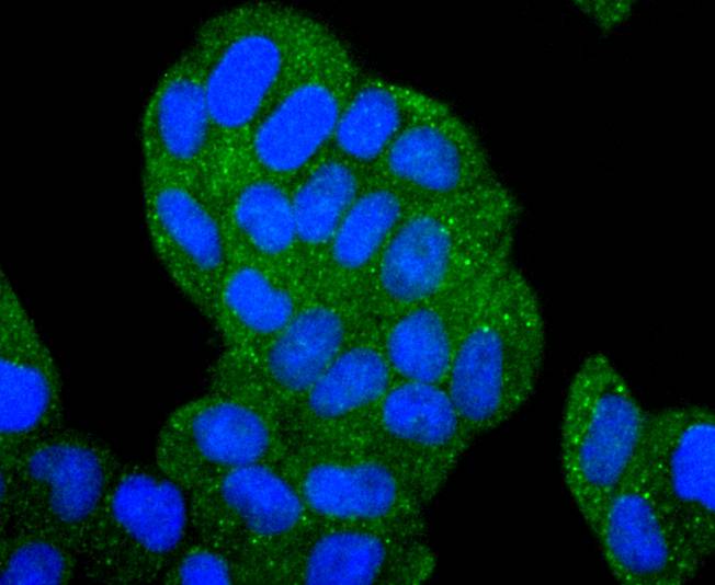 HDAC6 Rabbit mAb