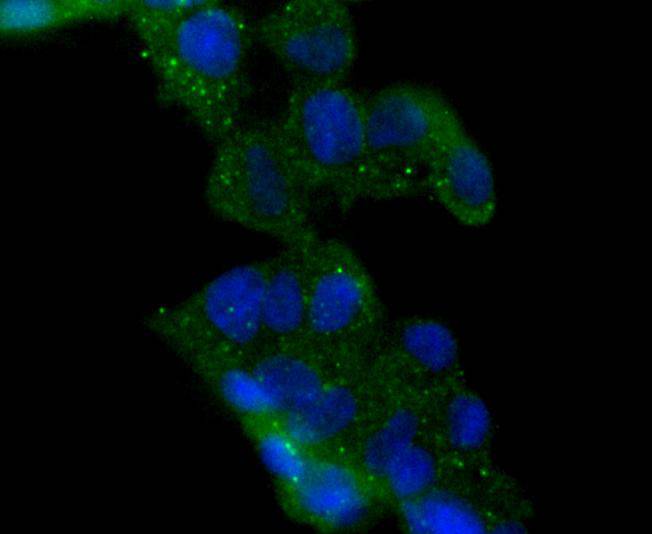 HDAC6 Rabbit mAb