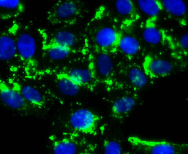 HDAC6 Rabbit mAb