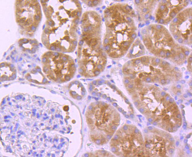 HDAC6 Rabbit mAb