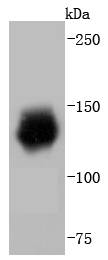 HDAC6 Rabbit mAb