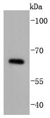 Cdc25B Rabbit mAb