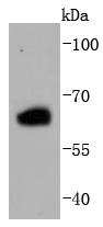 Estrogen Receptor beta Rabbit mAb