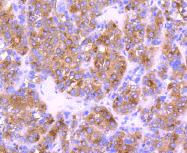 Cystatin C Rabbit mAb