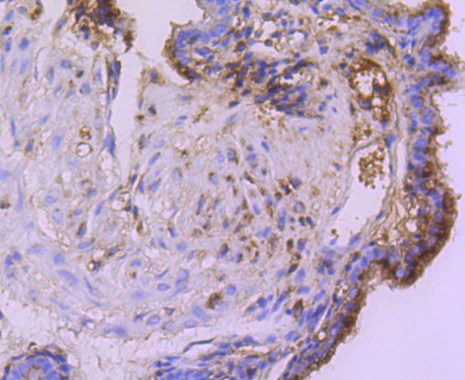 Cystatin C Rabbit mAb