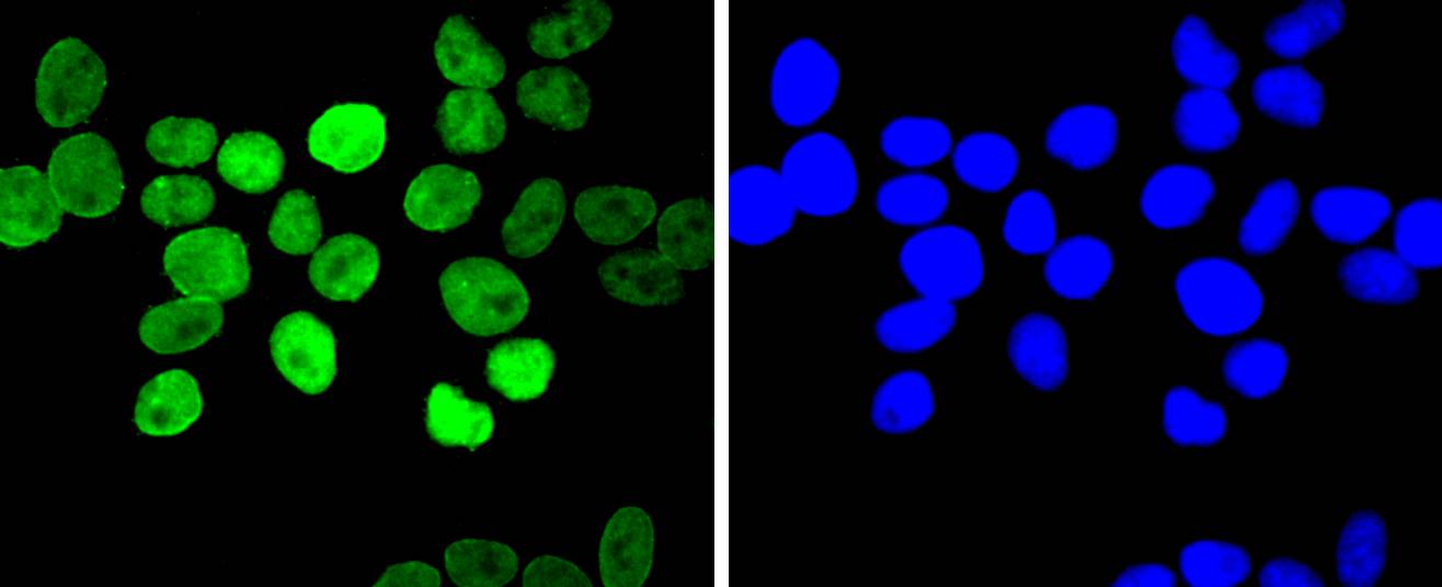 E2F1 Rabbit mAb