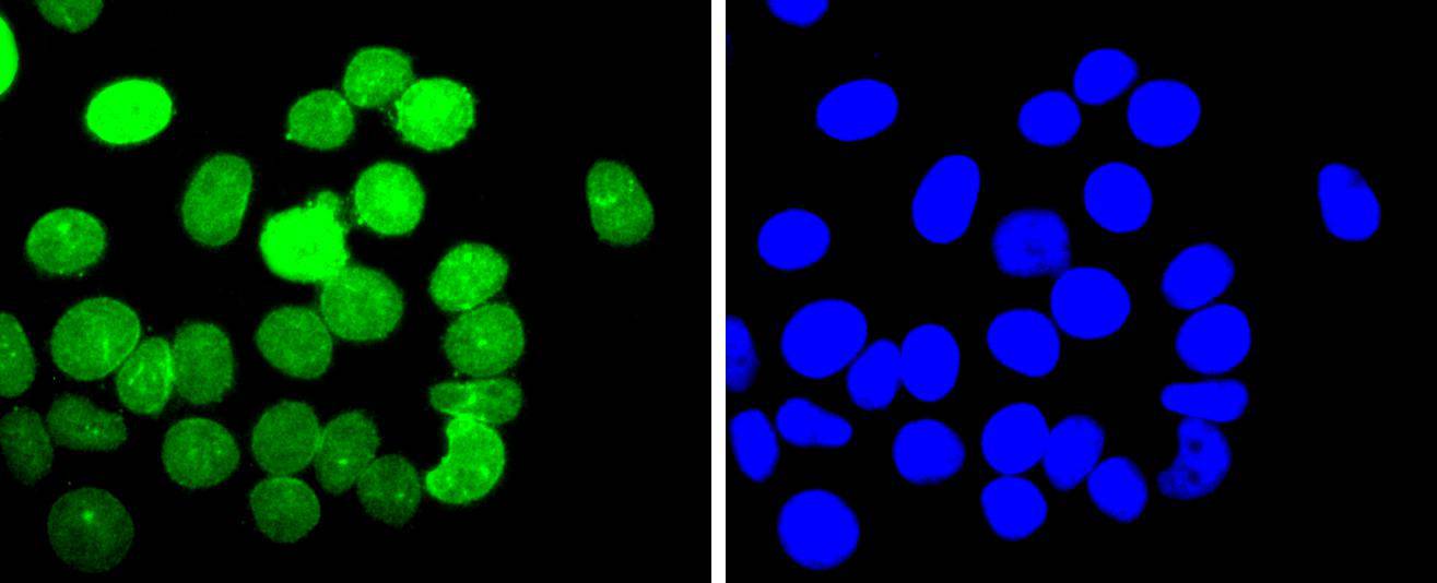 E2F1 Rabbit mAb