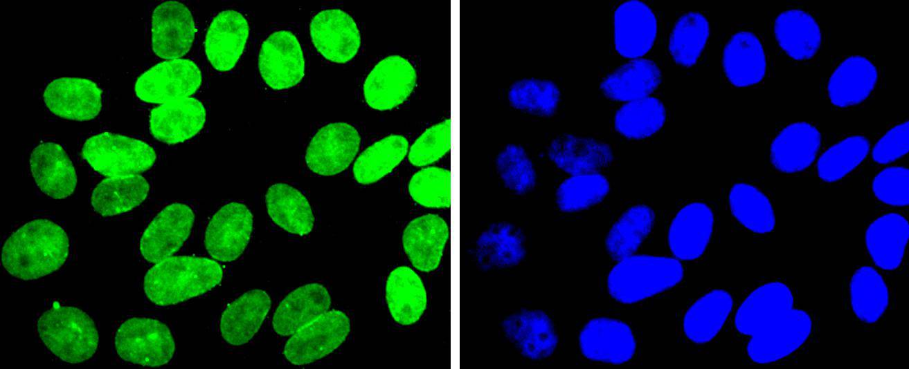 E2F1 Rabbit mAb